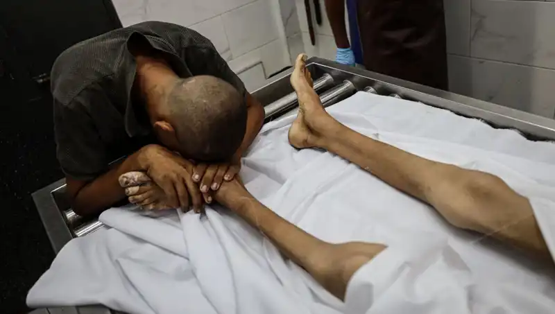 Gazze'de Bir Çocuk Açlık Nedeniyle Hayatını Kaybetti: Savaşın Gizli Yüzü