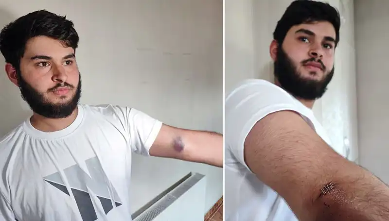 Bahçeye Kaçan Top, Mahallede Eğlenceli Kaos Yarattı!