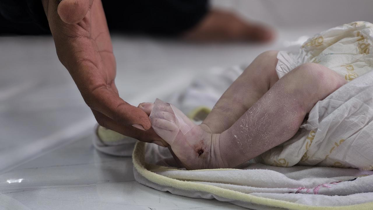 Gazze'de Donarak Ölen 35 Günlük Bebek